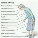 달서권투 | 파킨슨 Parkinson Disease