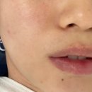 SY 메디칼 | [수원/에스테틱] 개인 맞춤형 아주대피부관리 Sy뷰티랩