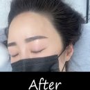 수민헤어스케치 | [인천탈모관리] 닷터스 인천청라, 헤어라인 콤플렉스 탈출한 솔직 후기