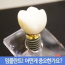 아이디치과기공소 | 부산임플란트 세종치과 임플란트란 무엇이고 어떤게 좋나요?