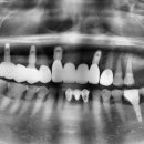 이세상치과기공소 이미지