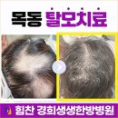청학한의원 | 오목교역한방병원 탈모 치료와 생활 습관 관리 함께한 후기