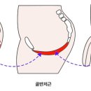 강화의료기