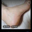 구리남양주 | 가능! 염증 없애고 면역력 높여주는 콜렌온열매트 사용 후기·남양주시ㆍ의정부·구리·양주 ·경기북부