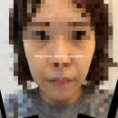 삼일광고디자인 - 아산시 번영로 153-2 | 광주 스컬트라 효과 내돈내산 스컬트라후기 스컬트라가격 볼패임