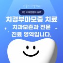 상주미소담치과의원 | 치경부마모증, 레진이랑 g.i 각각 비용과 수명은? 중계동 충치 치과에서 공개