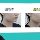 범계예쁨주의쁨의원 네이버블로그