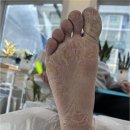 우진메디칼 | 천안발각질 남자발관리 잘하는 오네또 문제성발전문점 각질 무좀 내성발톱