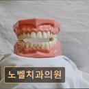 노벨치과의원 네이버블로그