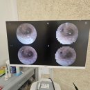 광주 보청기 이미지