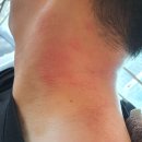 르와짐 | 뒷목 근육 통증, 비수술요법으로 제거한 이 방법 [광장동PT 르와짐]