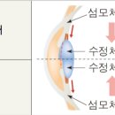 아름다운세상안경원 이미지