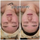 에스케이플라즈마(주) | 대연동피부관리 이중턱V케어 수안결에스테틱 솔직후기