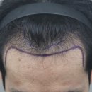 모나라피부과의원 이미지