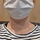 후즈후피부과의원 | 수유역 피부과 라르떼의원 비립종 쥐젖 제거 내돈내산 후기 (가격, 통증, 관리까지)