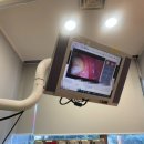 이지영치과의원 | 강남 학동역 치과 레진 인레이 후기