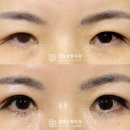 디비성형외과의원 이미지