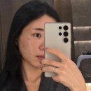 우주사 | 킴카다시안 메타셀 줄기세포주사 청담동 피부과 후기, 비포애프터 비교