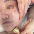 [대구] 북구 피부관리 추천, 그리다뷰티&amp;네일 셀린브리티 윤곽관리 후기