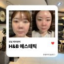 에이치탑1 | 강남피부관리 | 에이치앤비에스테틱에서 얼굴 라인 관리 받고 갸름해진 후기