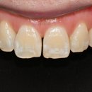 연세화이트치과의원 이미지