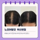 7193 | 예비신부 가르마 커버 후기, 웨딩촬영 전에 고민 해결한 이야기