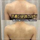 프롬더윤 | 청주웨딩관리 드레스라인 관리로 직각 어깨 만든 프롬더윤에스테틱 솔직후기
