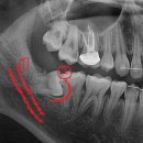호평나무치과의원 이미지