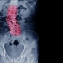 서울척척마취통증의학과의원 이미지