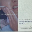 보석플란트치과의원 네이버블로그