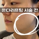 신사2-002 | 신사 온다리프팅 제로클리닉 후기