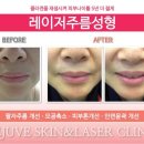 강남레쥬베의원 네이버블로그