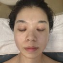 빈스헤어 - 광명시 광덕산로 5 | [김해피부관리] 빈스뷰티 3회차 후기 (탕후루 피부)
