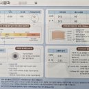 보라메트로약국 | [대구] 메트로안과 스마일라식 후기_내돈내산