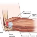 물리치료사가 알려주는 통증관리 이미지