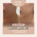 [화성봉담/피부관리] 드봉에스테틱 리프팅 리얼 후기｜30대 탄력관리 추천
