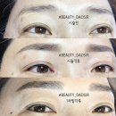 뷰티다오실 | 콤보눈썹+점막아이라린 탈각후기