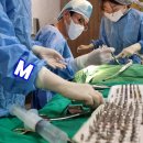 엠치과의원(시지점) | 시지치과 엠치과 구강스캐너를 통한 임플란트 보철과 구강 건강 관리 가이드