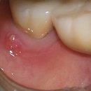 바른윤치과의원 이미지