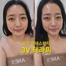 세븐일레븐 오산로점 | 오산웨딩케어 신부관리 아네스뷰티에서 3V테라피 받고 얼굴 붓기 뺀 후기