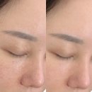 제이케어숍 | 동작구 상도동 피부관리 1:1 맞춤 케어 솔직후기 [제이뷰티]