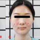 본메디케어 이미지