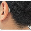 오티콘보청기 노원점 이미지