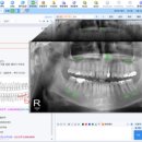 삼성덴탈 이미지