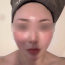 창원에스테틱,상남동에스테틱 추천 : 끌리메창원점 작은얼굴 관리 후기