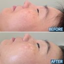 더_28랩(The_28LAB) | 천안피부관리 추천 l 주차 편한 천안시청 피부샵 · 천안 문제성 피부샵 "티아뷰티랩 스킨&amp;네일" 후기