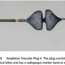 Low profile vascular plug for transarterial occlusion of PDA in small dogs 이미지