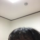 (주)로터스블랑 | 2월 21일 ~ 29일 (발가락 골절, 메인 핀 제거)