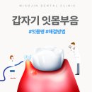 미소진치과 - 전주시 덕진구 안덕원로 259 | 부산 개금 치과 후기 발치 전 꼭 보세요!