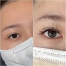 이수래쉬 네이버블로그